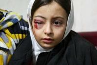 ۲۸۱۷ نفر در حوادث چهارشنبه سوری مصدوم شدند/فوتی ها به ۱۹ نفر رسید