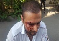  ضرب و شتم نیروی اورژانس تهران به دلیل پلاک نداشتن آمبولانس!
