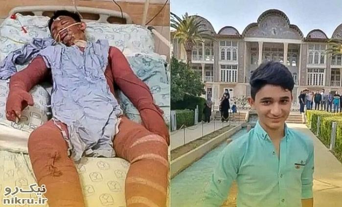 دستور وزیر کشور به استانداران اصفهان و خوزستان برای پیگیری عاجل درمان نوجوان فداکار ایذه ای